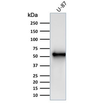 Vimentin Antibody