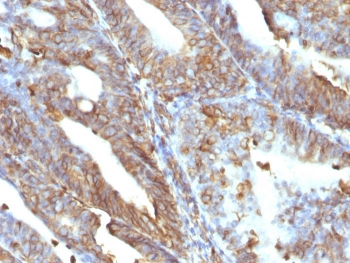 Vimentin Antibody