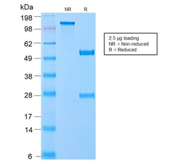 Recombinant VLDL Receptor Antibody / VLDLR