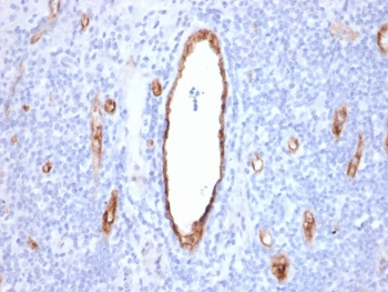Recombinant vWF Antibody / von Willebrand Factor