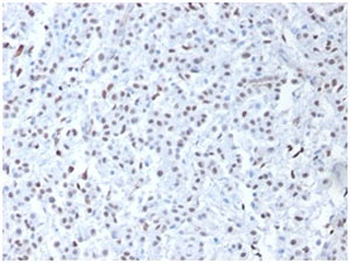 WT1 Antibody / Wilms Tumor 1