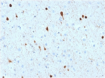 Calbindin 2 Antibody / CALB2 / Calretinin
