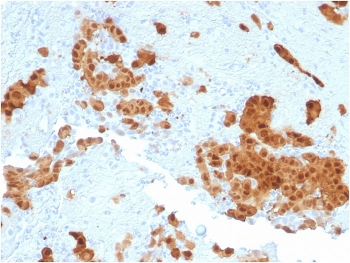 Calbindin 2 Antibody / CALB2 / Calretinin