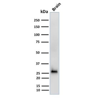 Calbindin 2 Antibody / CALB2 / Calretinin