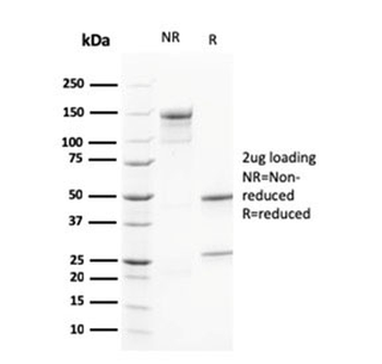 Calbindin 2 Antibody / CALB2 / Calretinin
