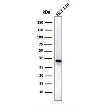 VTCN1 Antibody / B7H4