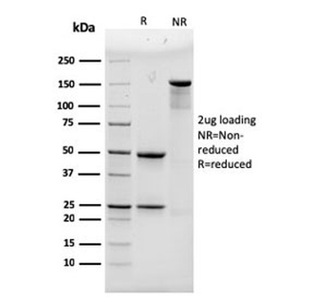 Alpha Actinin 4 Antibody / ACTN4