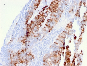 TRAIL R2 Antibody / DR5