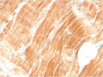 ACTN2 Antibody / Alpha Actinin 2 / Sarcomeric Alpha Actinin