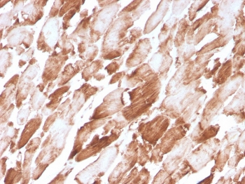ACTN2 Antibody / Alpha Actinin 2 / Sarcomeric Alpha Actinin