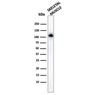 ACTN2 Antibody / Alpha Actinin 2 / Sarcomeric Alpha Actinin
