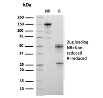 ACTN2 Antibody / Alpha Actinin 2 / Sarcomeric Alpha Actinin
