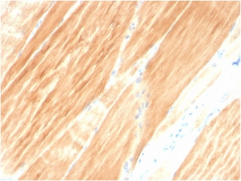 ACTN2 Antibody / Alpha Actinin 2 / Sarcomeric Alpha Actinin
