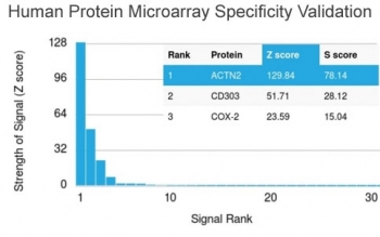 ACTN2 Antibody / Alpha Actinin 2 / Sarcomeric Alpha Actinin