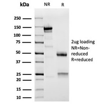 ACTN2 Antibody / Alpha Actinin 2 / Sarcomeric Alpha Actinin