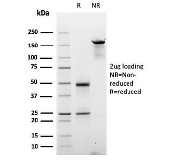 Cyclin E1 Antibody / CCNE1