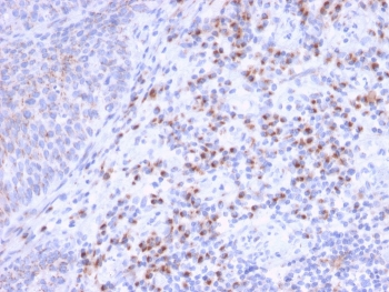 EBAG9 Antibody / Estrogen Receptor Binding Site Associated Antigen 9