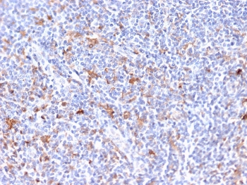 EBAG9 Antibody / Estrogen Receptor Binding Site Associated Antigen 9
