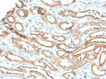 Aurora B Antibody / AURKB