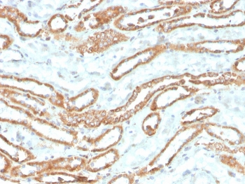 Aurora B Antibody / AURKB