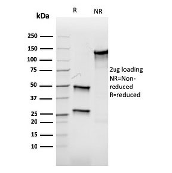 Aurora B Antibody / AURKB