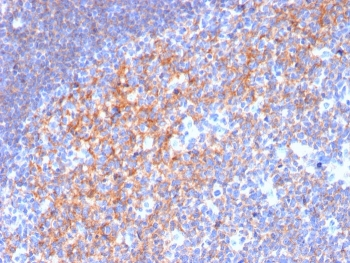 CD19 Antibody / B-lymphocyte marker