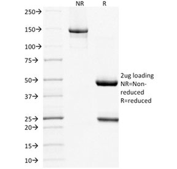 MUC16 Antibody / CA125