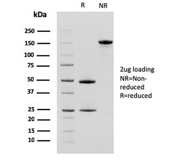 CD10 Antibody / Neprilysin