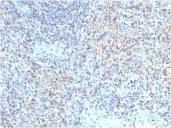 CD40L Antibody / TRAP / CD154