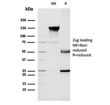 CD40L Antibody / TRAP / CD154
