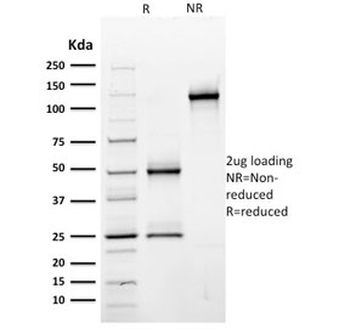 CD44 Antibody / HCAM