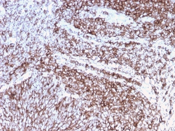 CD44 Antibody / HCAM