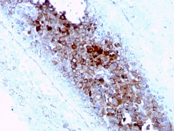 CD63 Antibody / LAMP-3