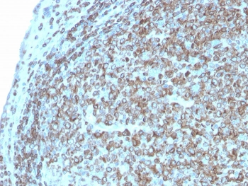CD74 / CLIP Antibody