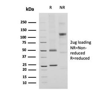 CD74 / CLIP Antibody
