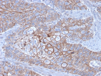 E-Cadherin Antibody / CDH1