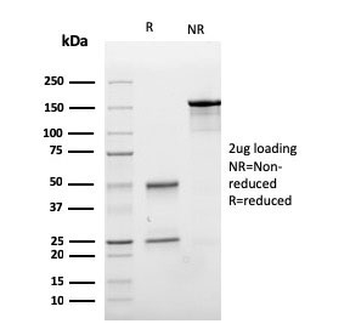 E-Cadherin Antibody / CDH1