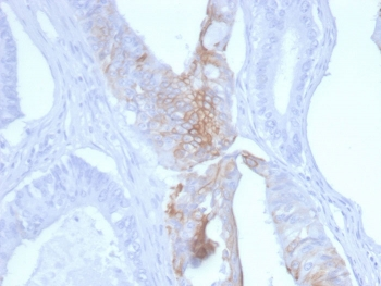 Cytokeratin 20 Antibody / CK20