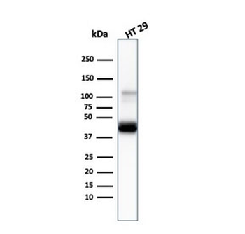 Cytokeratin 20 Antibody / CK20