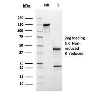 Cytokeratin 20 Antibody / CK20