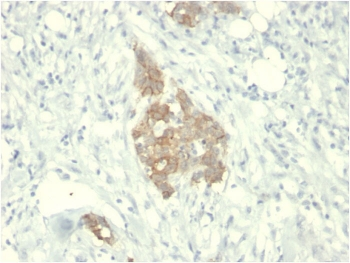c-RET Antibody