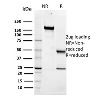 Maltose Binding Protein Antibody / malE / MBP tag