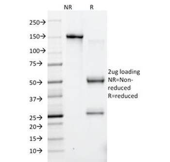 HSV1 Antibody / Herpes Simplex Virus Type I