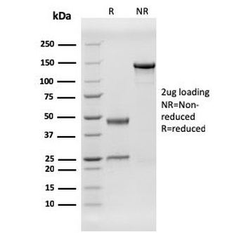 Herpes Virus 8 Antibody