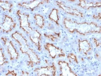Interferon gamma Antibody / IFNG