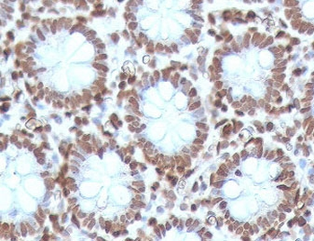 CDX2 Antibody