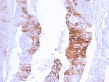 Cytokeratin 20 Antibody / CK20