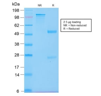 Cytokeratin 20 Antibody / CK20