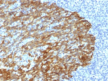 Basic Cytokeratin Antibody (HMW / Type II)