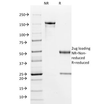 HPV-16 E6 Antibody